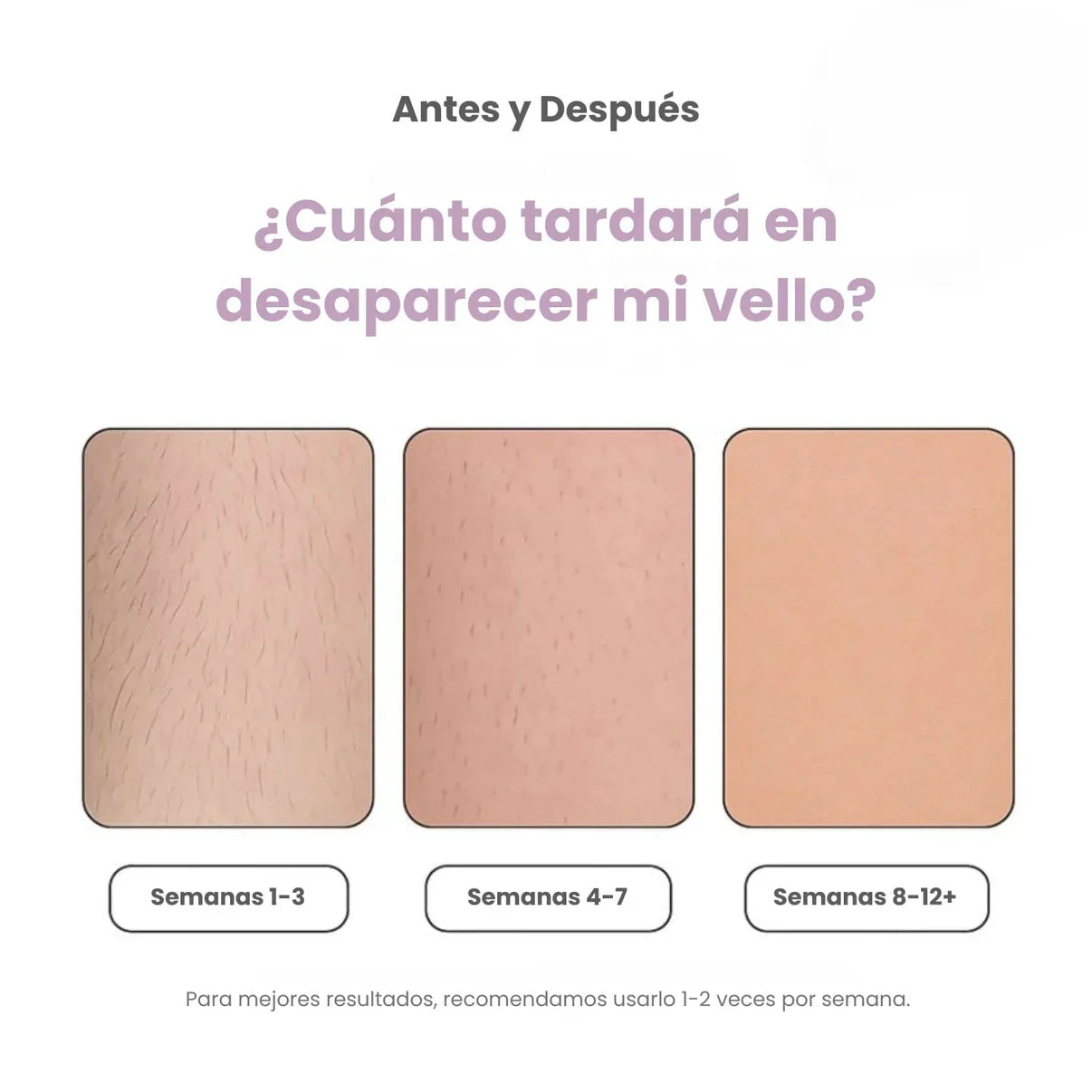 DEPILADORA LÁSER PERMANENTE (+ Regalo)