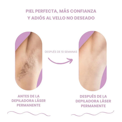 DEPILADORA LÁSER PERMANENTE (+ Regalo)